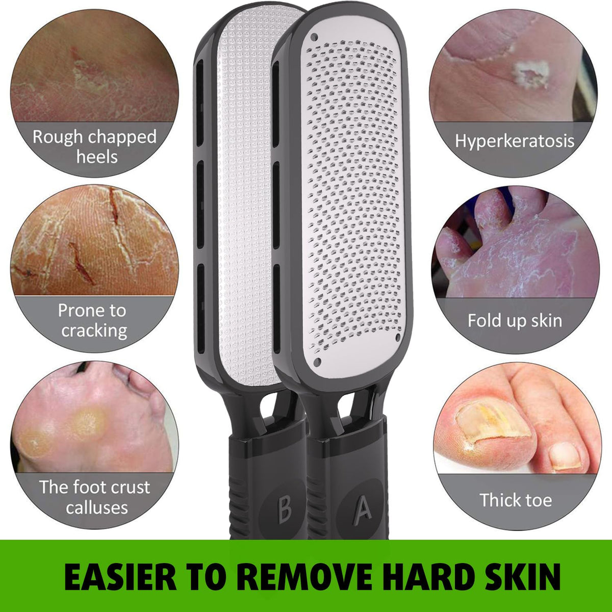 Antonki 2-in-1 Foot File Scrubber Feet Rasp for Dead Skin, Callus, Corn
