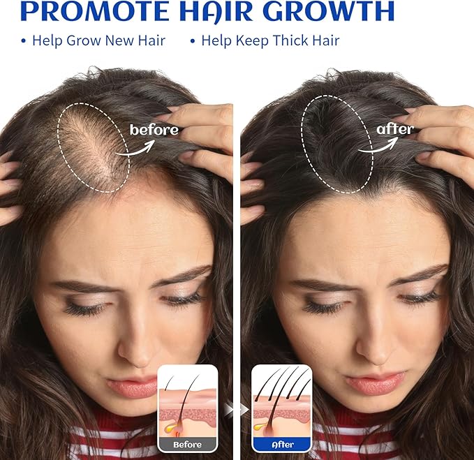HIQILI Rosemary Essential Oil for Hair, Diffuser, Skin & Aromatherapy
