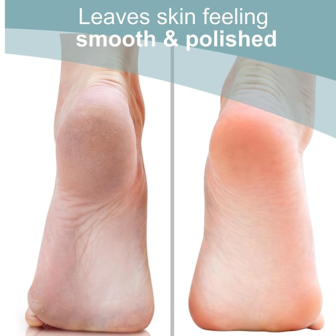 TRIM Nano Glass Foot File, Professional Callus Remover & Pedicure Tool