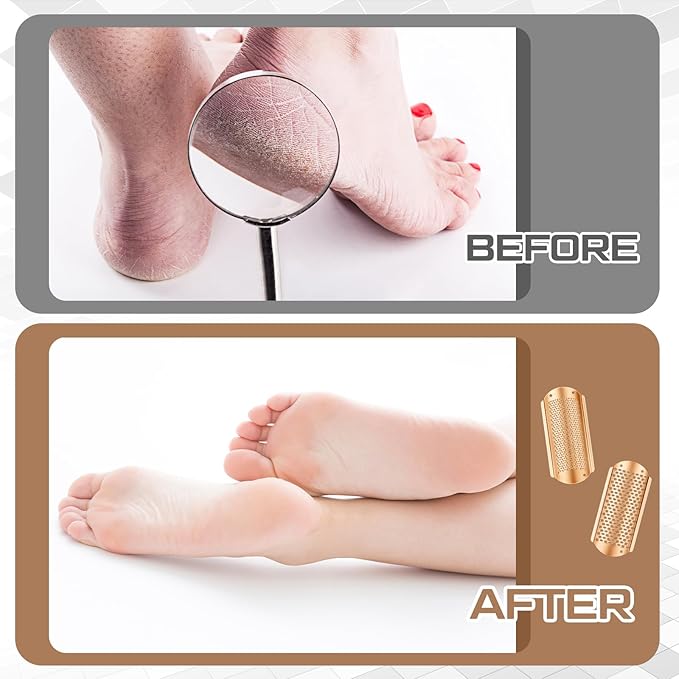 Moxweyeni 8 Pack Rose Gold Foot File Callus Remover Replacement Blades Metal Pedicure Rasp Hard Skin Remove Scrubber Stainless Steel 2 Designs Big/fine Hole for Detachable Foot Grater