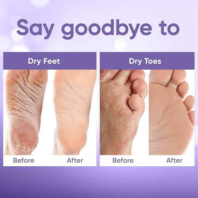 CÉLOR Foot Peeling Mask for Dry Cracked Feet | Foot Mask to Exfoliate Rough, Cracked, Dry Feet, Calluses for Soft Baby Feet Results | Made with Aloe Vera Extract for Women & Men (5 Pairs) | Lavender