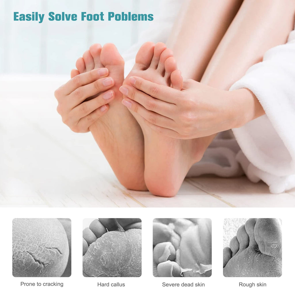 FVION Foot File Callus Remover Cracked Heel Shaver – Double Sided Pedicure File/Foot Scraper for Wet and Dry Feet