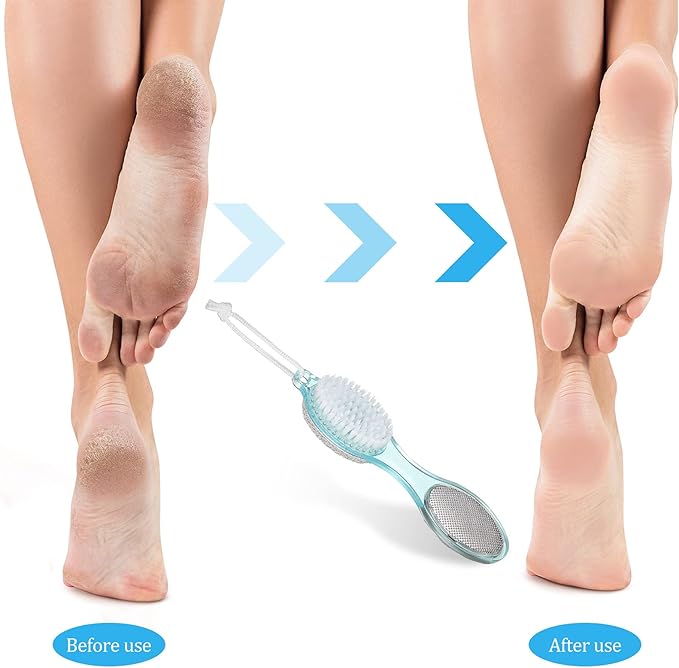 Sieral 4 Pack Pumice Stone Brush for Feet 4 in 1 Scrubber Foot Care Pedicure Kit with Grinding Pumice, Cleaning Brush, Foot File and Rubbing Footplate for Women Men Home Care Set