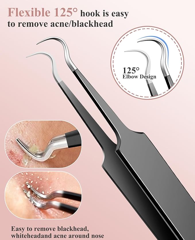 5PCS Blackhead Remover Pimple Popper Tool Kit, Professional Stainless Pimple Acne Blemish Removal Tools Kit for Face (Black)