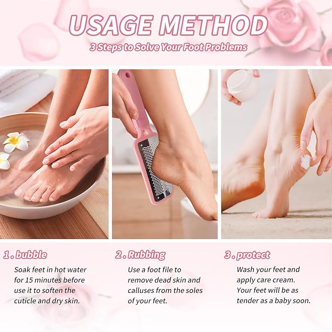 Foot Callus Remover – Professional Stainless Steel Foot File for Dead Skin, Callus & Hard Skin Removal – Ergonomic Design for Smooth, Baby-Soft Feet (Pink)