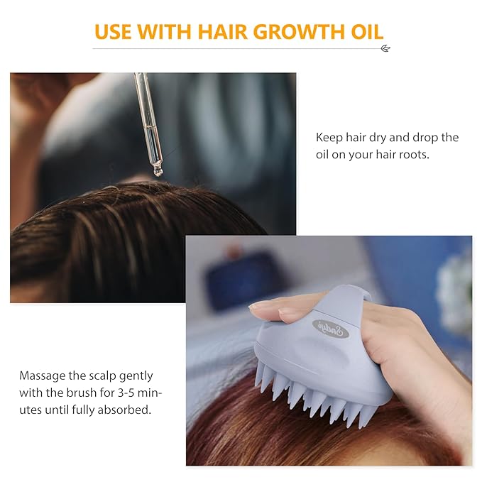 Sndyi Scalp Massager Shampoo Brush, Scalp Scrubber with Soft Silicone Bristles, Scalp Exfoliator for Dandruff Removal, Scalp Massager for Hair Growth, Wet Dry Hair Brush for Scalp Care, Sky Blue