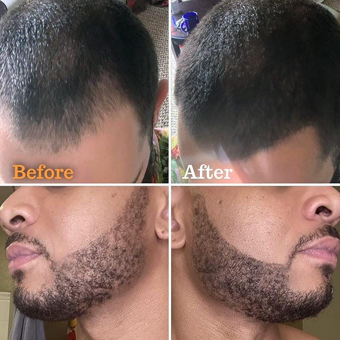 Beard Pen Filler for Men - Barber Styling Grooming Pencil - Waterproof, Sweat Proof, Long Lasting Solution with Natural Finish - Cover Beard and Scalp Patches in Seconds - Medium Brown 1 Pack