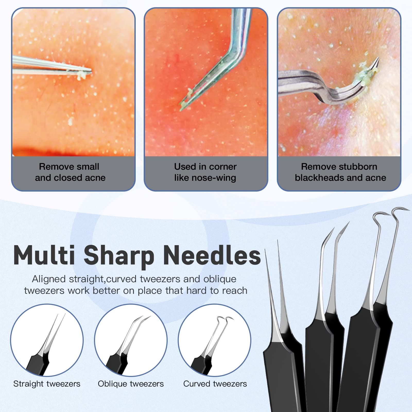Professional Pimple Popper Tool Kit,10 PCS Blackhead Remover Tweezers,Extractor Acne Removal Kit for Easy Removal for Pimples,Comedone Extractor Tools for Removing Zit,Acne Removal Kit (Black)