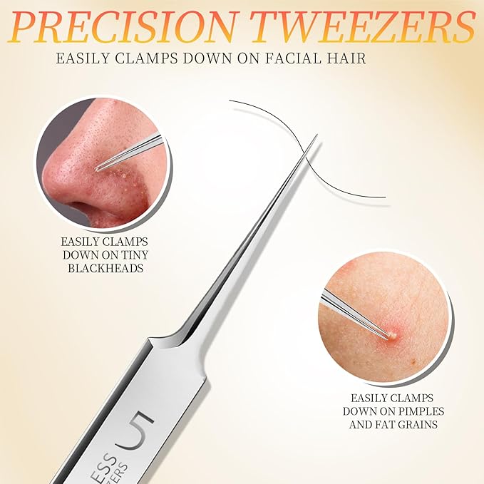 Teenitor 4 Pcs Professional Blackhead Tweezers and Pimple Popper Tool Kit, Stainless Steel Cell Tweezers for Blackhead, Pimple, Whitehead, Ance