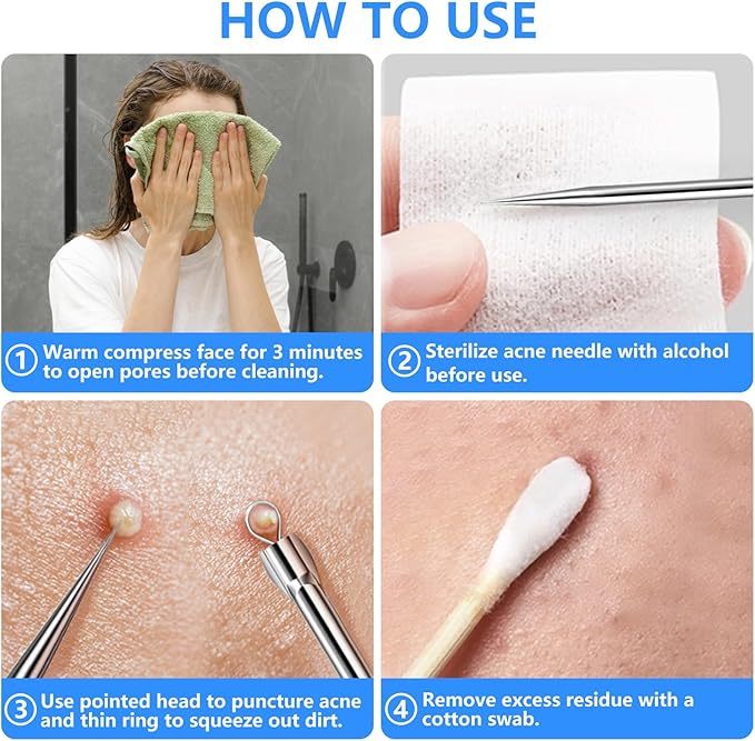 AskBed 5PCS Blackhead Remover Comedone Extractor Kit