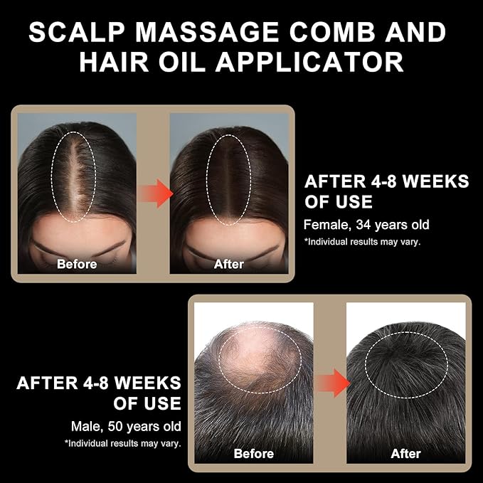 DongBlitz Red Light Scalp Massager for Hair Growth, Electric Hair Growth Comb with Kneading Massage & Red Light Therapy, for Visible Hair Loss & Thinning Hair, Minoxidil Applicator Scalp Brush