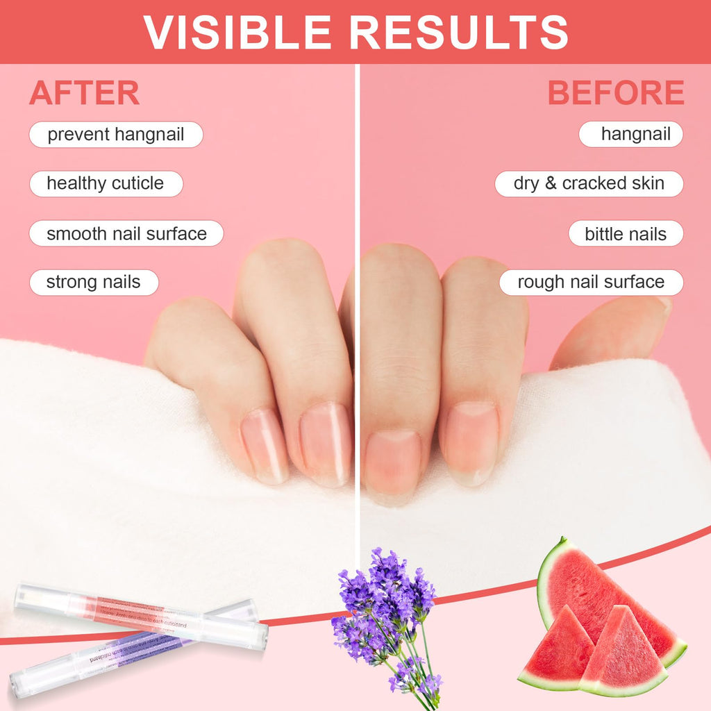 Meschett 3PCS Nail Cuticle Oil Pens with Nail File, Natural Cuticle Oil for Nail Care, Moisturizing Nail Oil for Dry Nails & Cuticles (Lavender & Watermelon & Osmanthus flowers Flavor)
