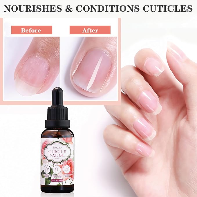yonisayo 3 in 1 Cuticle Oil, 3 Pack Rose Nails Care Oil to Strengthen Brittle Nails, Hydrate Dry Cuticles & Soften Hands, Fast-Absorbing