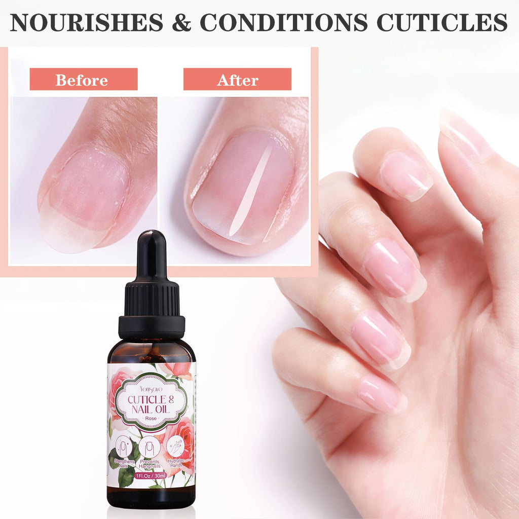 yonisayo 3 in 1 Cuticle Oil, 3 Pack Rose Nails Care Oil to Strengthen Brittle Nails, Hydrate Dry Cuticles & Soften Hands, Fast-Absorbing