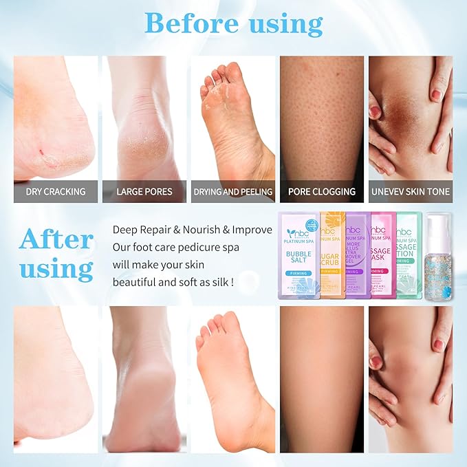 nbc BeautiLab Pedicure Foot Soak Set - Upgraded 6 in 1 Foot Spa, Foot Bath Spa, Pedicure Kit, Foot Soak for Tired & Dry Cracked Feet, Athletes Feet, Bad Odor, Softens Calluses (Pearl)