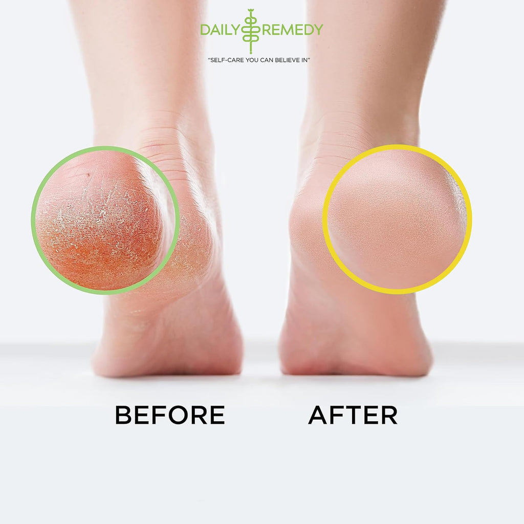 DAILY REMEDY EXTRA STRENGTH Tea Tree Oil & Citrus Detox Foot Soak Set - Made in USA - Soothes Sore Tired Feet, Athletes Foot, Stubborn Foot Odor, Softens Calluses & Refreshes & Detoxifies - Pack of 2