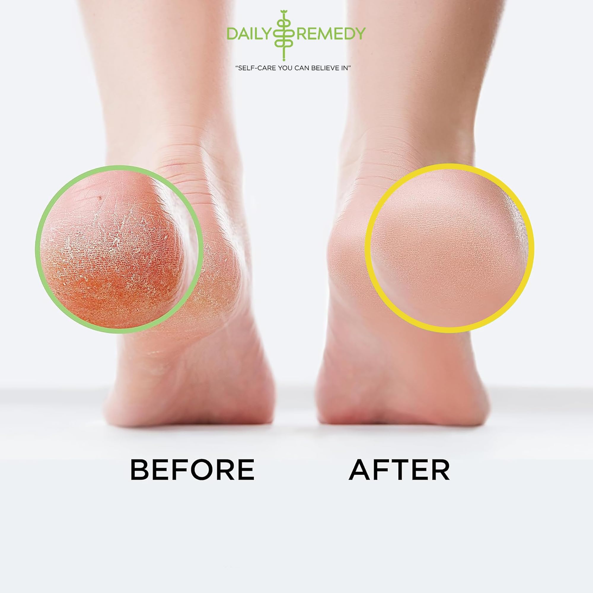 DAILY REMEDY EXTRA STRENGTH Tea Tree Oil & Citrus Detox Foot Soak Set - Made in USA - Soothes Sore Tired Feet, Athletes Foot, Stubborn Foot Odor, Softens Calluses & Refreshes & Detoxifies - Pack of 2