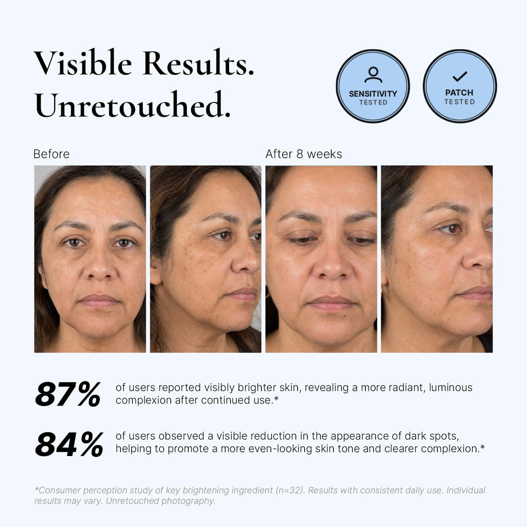 EnaSkin Dark Spot Corrector & Remover for Face & Body, 5% Tranexamic Acid
