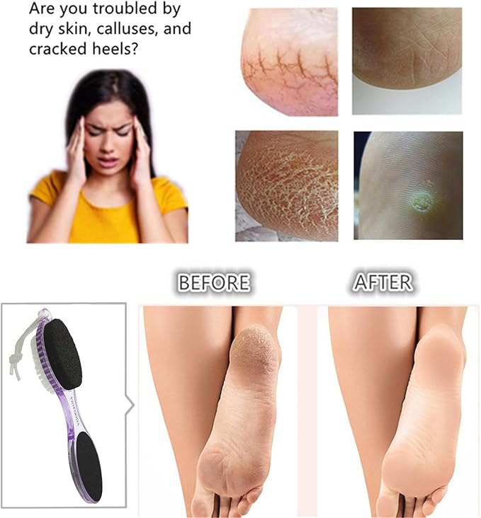 Foot File Callus Remover 4-in-1, Feet Scraper Pedicure Tools with Pumice Stone, Scrubber Brush, Foot Rasp and Sand Paper, Double Sided Multi Purpose, Clear Pink and Purple
