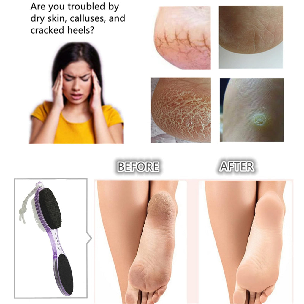 YIOYOODA Foot File Callus Remover 4-in-1, Feet Scraper Pedicure Tools with Pumice Stone, Scrubber Brush, Foot Rasp and Sand Paper, Double Sided Multi Purpose, Clear Blue and Purple