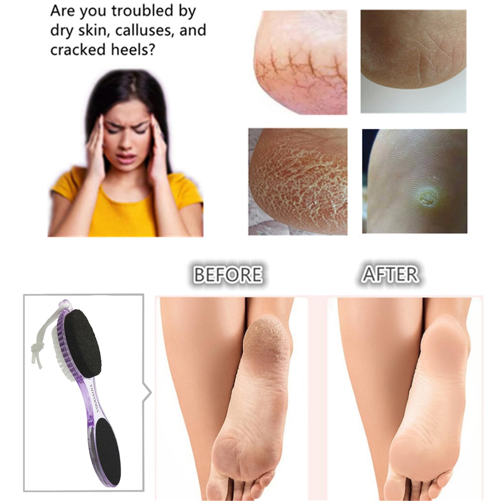YIOYOODA Foot File Callus Remover 4-in-1, Feet Scraper Pedicure Tools with Pumice Stone, Scrubber Brush, Foot Rasp and Sand Paper, Double Sided Multi Purpose, Clear Blue and Purple