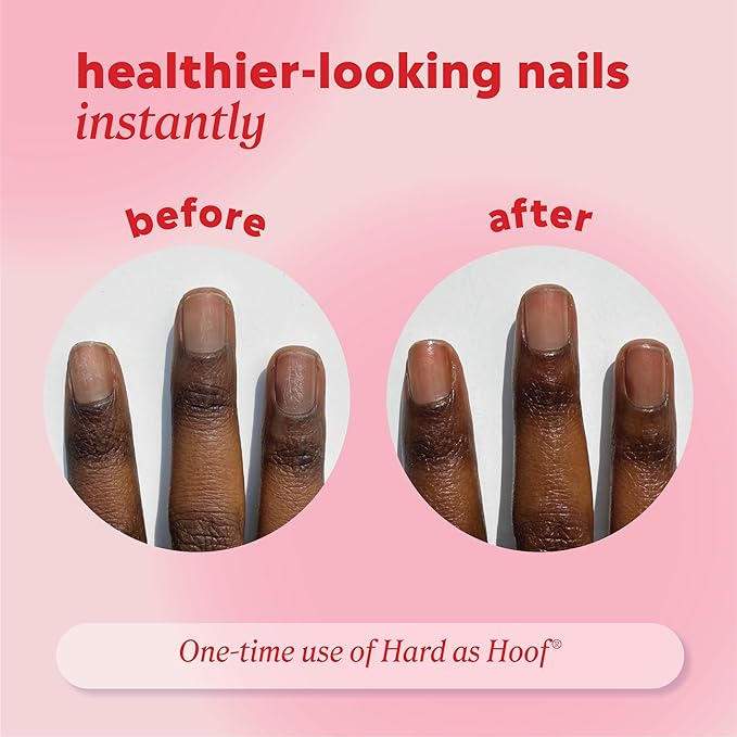Onyx Professional Hard as Hoof Nail Strengthening Cream, Cherry Almond Scent - Made in USA, Nail Growth & Conditioning Cuticle Cream Stops Splits, Chips, Cracks & Strengthens Nails, 1 oz