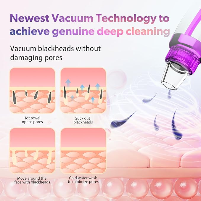 2026 Blackhead Remover Pore Vacuum, 5 Adjustable Suction Levels, 5 Probes, USB Rechargeable