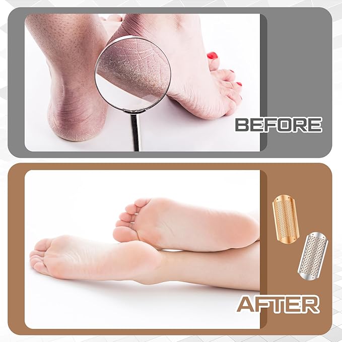 Moxweyeni 8 Pack Rose Gold,Silver Foot File Callus Remover Replacement Blades Metal Pedicure Rasp Hard Skin Remove Scrubber Stainless Steel 2 Designs Big/fine Hole for Detachable Foot Grater