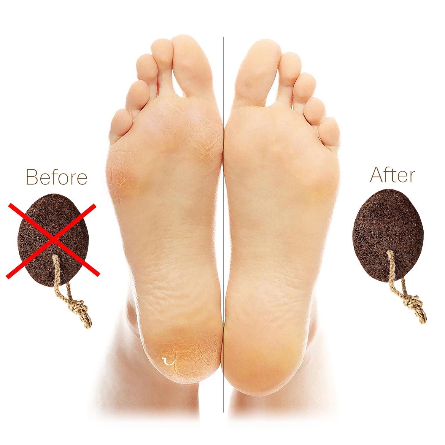 Pumice Stone for Feet - Natural Foot Scrubber for Dead Skin Callus Removal