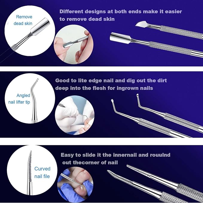 Ingrown Toenail File and Lifters Set(9pcs), Professional Pedicure Tool Toenail Grooming Kit, Ingrown Toenail Treatment Pedicure Kit, Under Nail Cleaner Tools (9PCS)