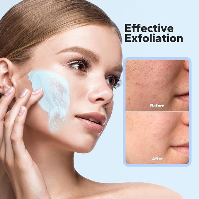 Face Exfoliator (4.23 Oz), Face Scrub, Microdermabrasion Facial Scrub Exfoliator with Natural Pumice, Peptides & Botanical Extracts, Facial Exfoliator for Smooth and Refreshed Skin