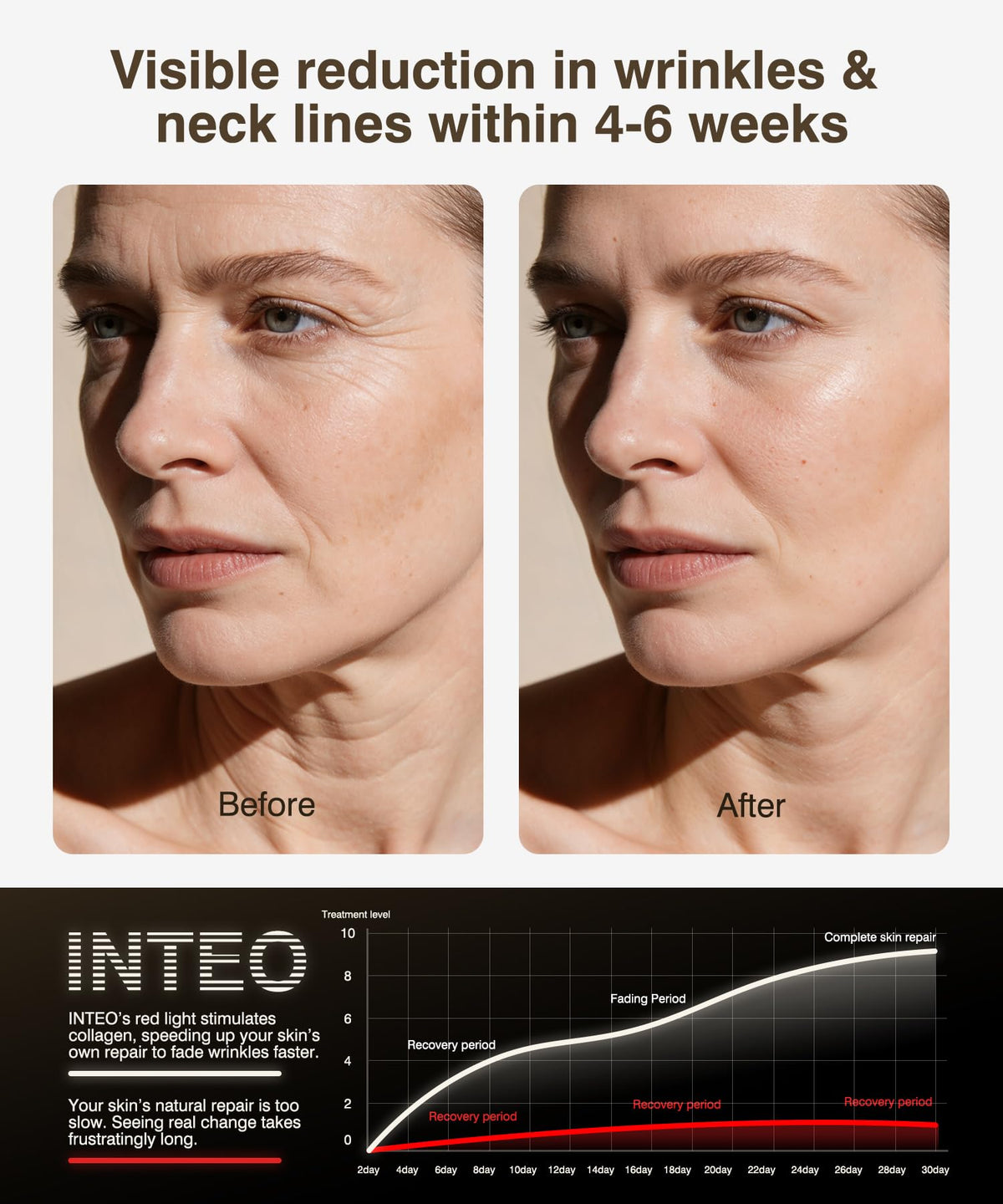 Red Light Therapy Mask for Face & Neck, Wireless LED Face Mask, 4 Modes