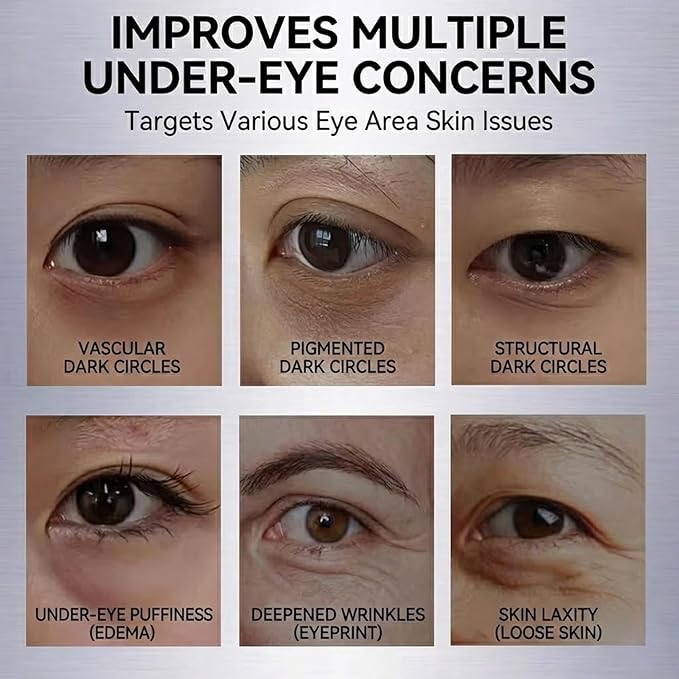 Rovian 8 Pack Reusable Eye Patches, Glitter Cooling Eye Gel Patches for Puffiness, Dark Circles and Quick Makeup Prep