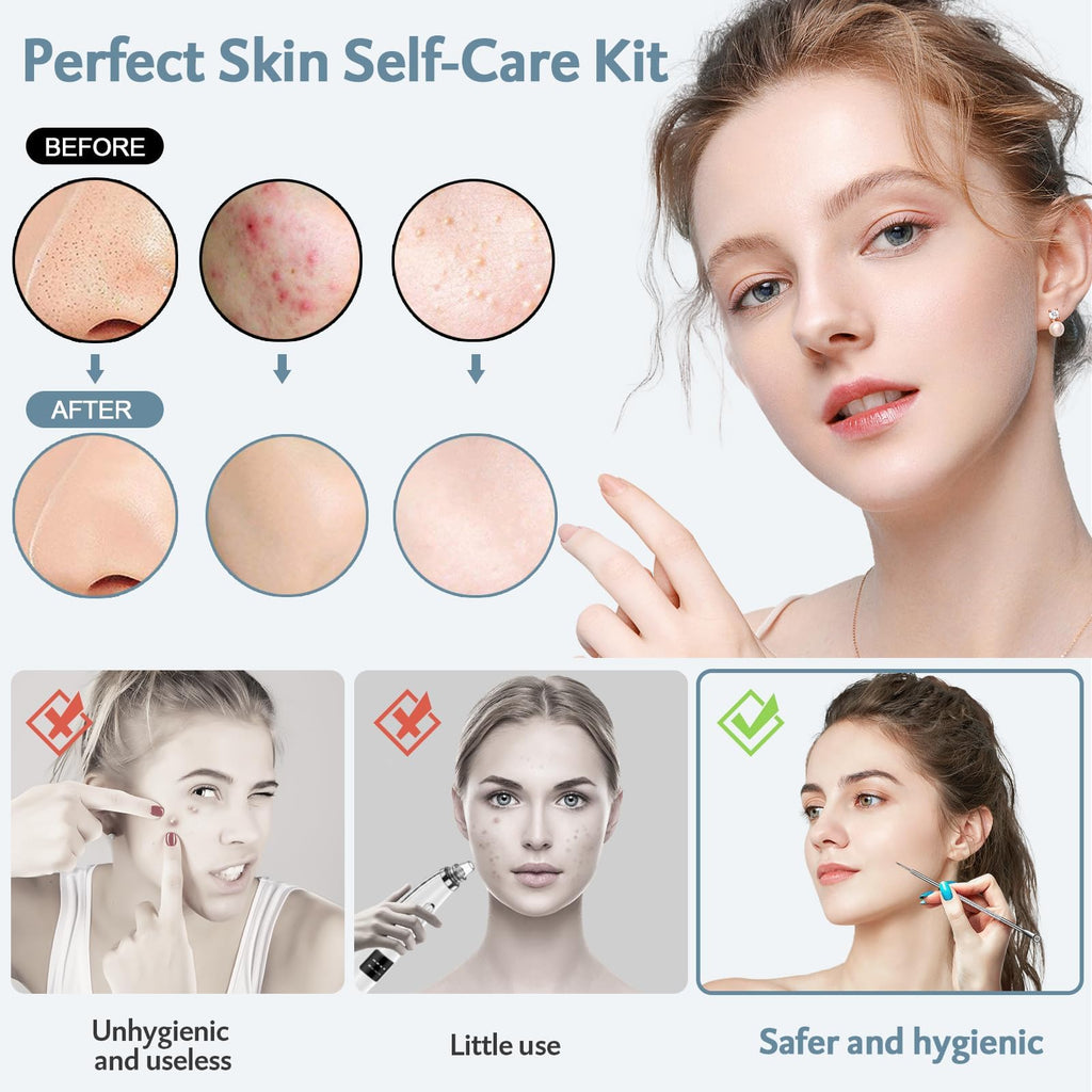 Blackhead Remover Tools MENOLY 10Pcs Pimple Popper Tool Kit, Blackhead Remover Extractor Tools, Anti-Slip Handle Pimple Comedone Extractor Acne Kit for Blackhead,Blemish,Zit Whitehead