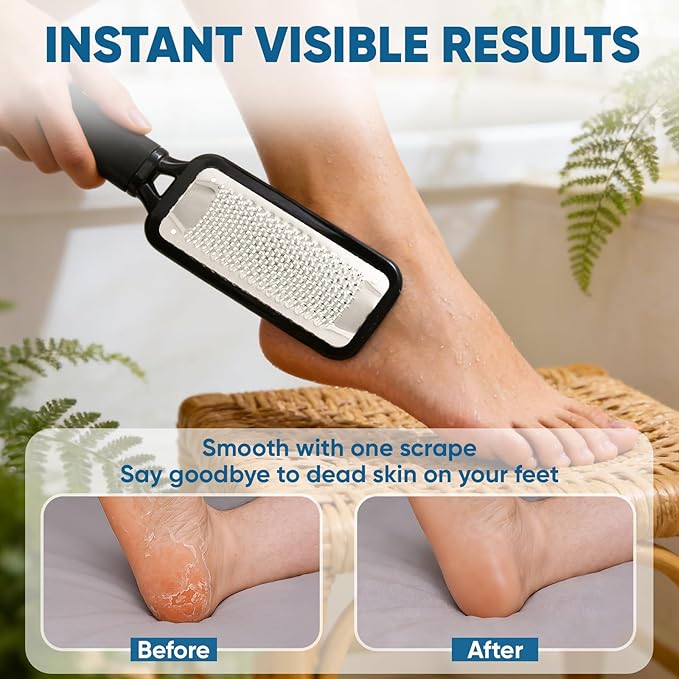 TEAWOO 3 Pack Foot Files Callus Remover, Stainless Steel Foot Rasp and Foot Scrubber, Professional Pedicure Tools for Dead Skin, Hard Skin and Calluses Removal