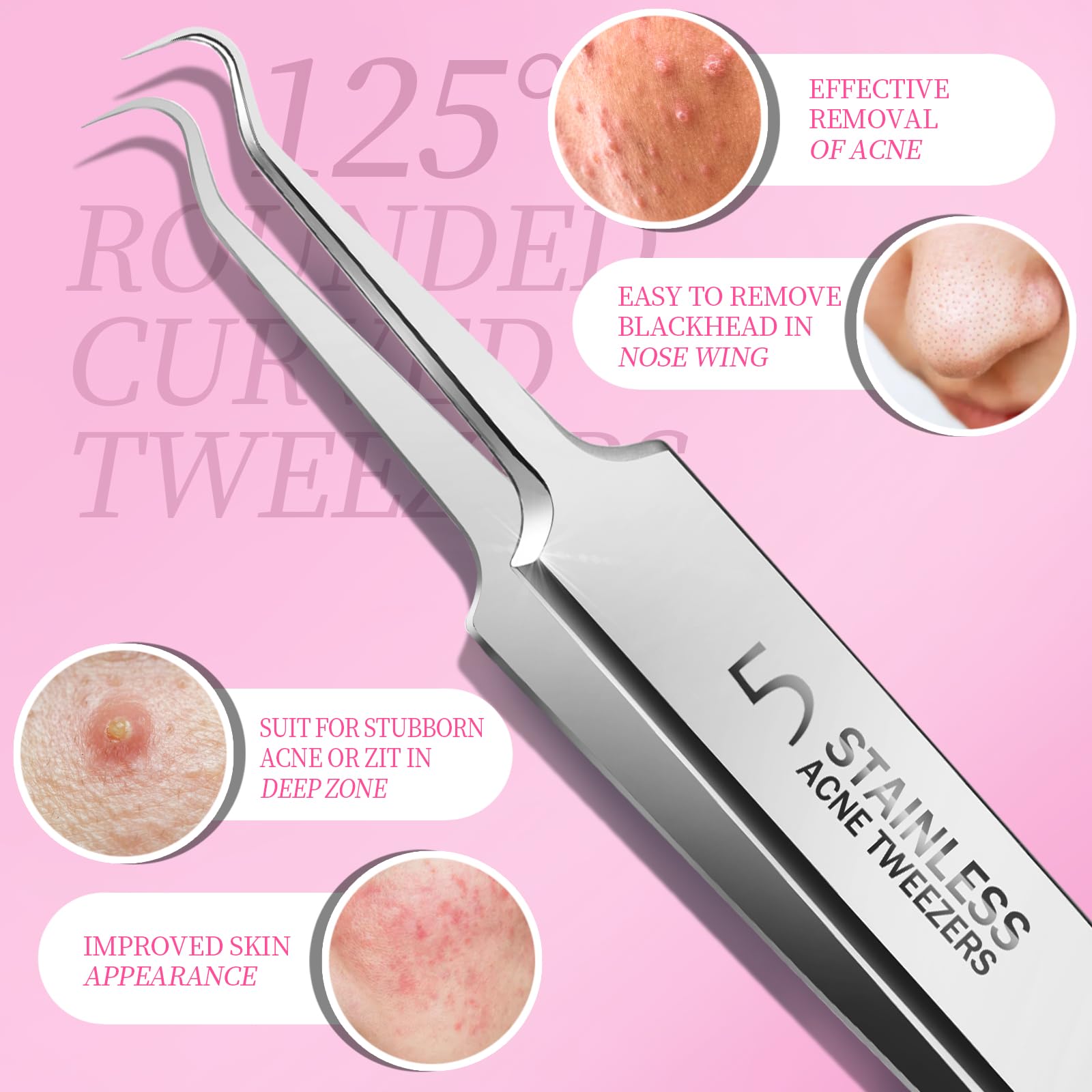 Teenitor Blackhead Remover and Pimple Popper Tool Kit, 2 Blackhead Extractor, 1 Ingrown Hair Tweezers, 2 Pimple Extractor Pore Extractor Blackhead Remover Tool Acne Tools
