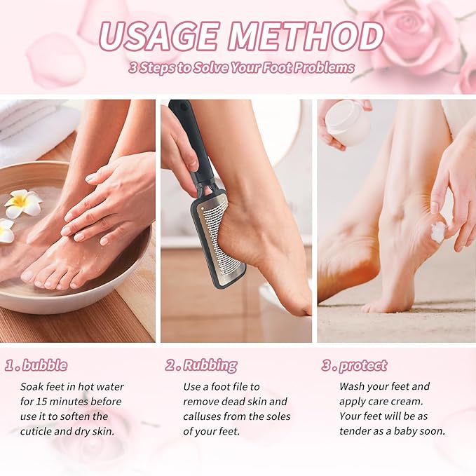 Foot Callus Remover – Professional Stainless Steel Foot File for Dead Skin, Callus & Hard Skin Removal – Ergonomic Design for Smooth, Baby-Soft Feet (Black)