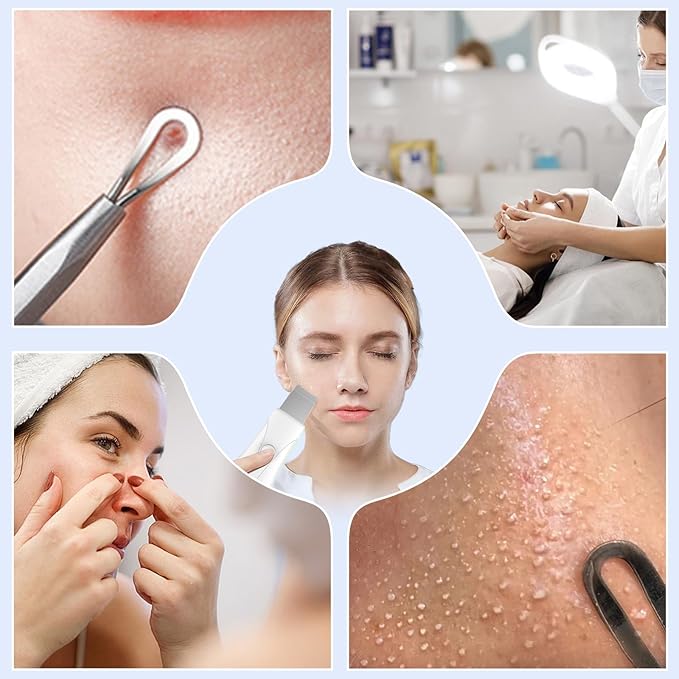 Skin Scrubber Face Spatula Skin Spatula Pore Cleaner Blackhead Remover Tools for Facial Deep Cleansing Skin Care Tool for Men and Women (White)