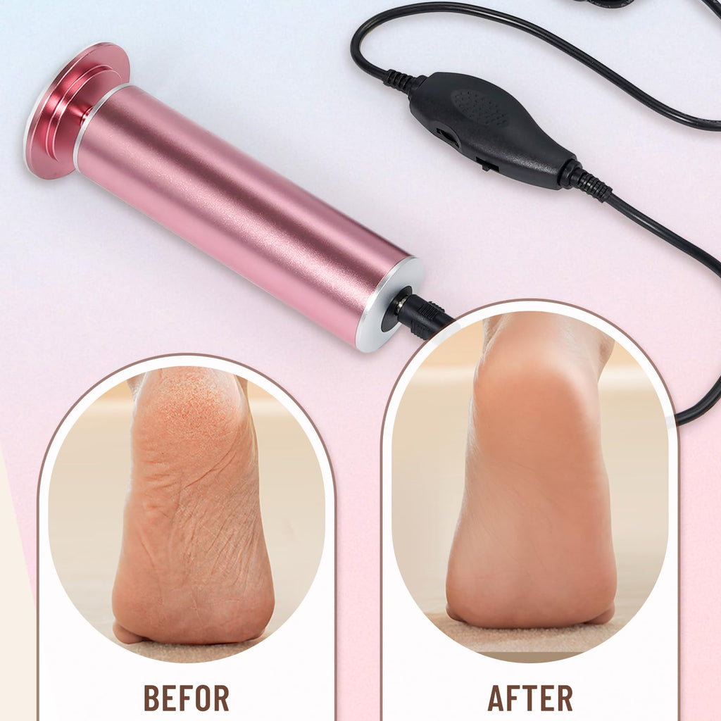 Dermawave Electric Foot File Callus Remover for Feet, Professional Electric Foot Sander Filer Grinder with 60 Sandpaper Discs for Men & Women, Pedicure Tool for Corn Dead Skin Cracked Heel