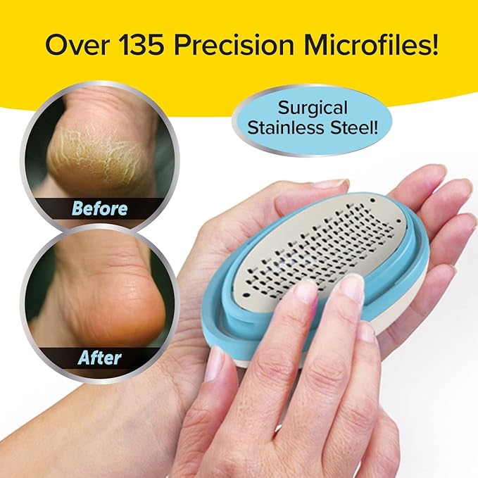 PedEgg Foot File, Painless Callus Remover, Mess-Free, As Seen on TV