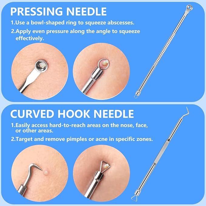 AskBed 5PCS Blackhead Remover Comedone Extractor Kit