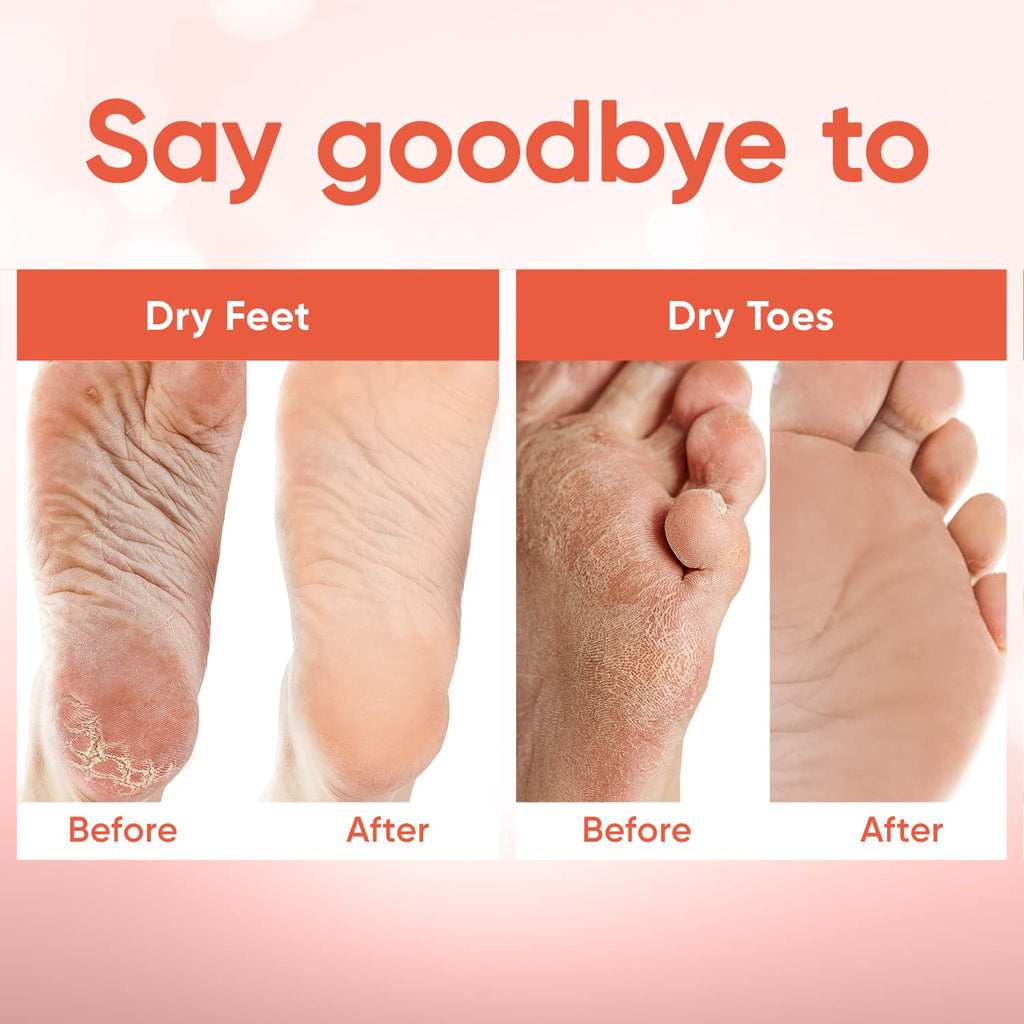 CÉLOR Foot Peeling Mask for Dry Cracked Feet | Foot Mask to Exfoliate Rough, Cracked, Dry Feet, Calluses for Soft Baby Feet Results | Made with Aloe Vera Extract for Women & Men (3 Pairs) | Peach