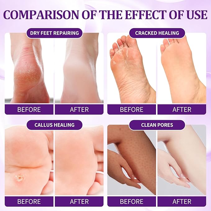 nbc BeautiLab 24 PCS Foot Soak, Pedicure Kit Foot Soak Set With Bubble Salt, Sugar Scrub, Massage Mask, Massage Lotion In a Box 4 Step Foot Spa Kit For Dry Cracked Feet, Tired Feet, 6 Set Lavender