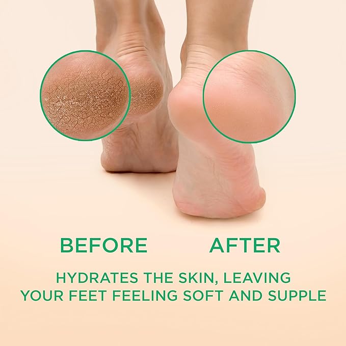 Lee Beauty Professional Callus Remover for Feet - Peppermint, Powerful Formulation - Extra Strength Gel, Home Pedicure Foot Spa Results - Cracked & Dead Dry Skin Supplies - 8 Ounce