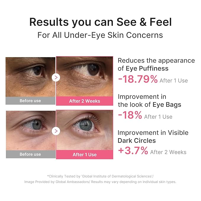 medicube Eye Patch PDRN Caffeine Collagen | Gel Eye Patches for the appearance of Dark Circles, Undereye Bags | Firming, Age-Defying Care with Retinol, Collagen | Korean Skincare | 30 Pairs