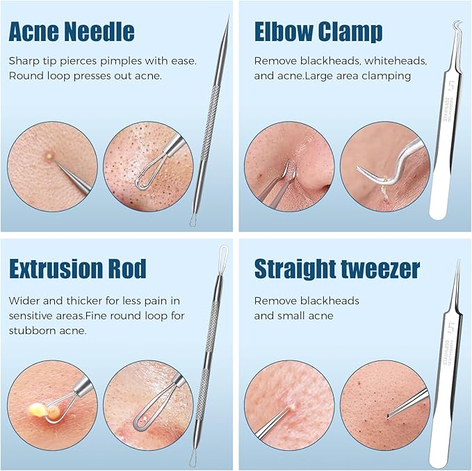 Blackhead Remover Tool Kit, 6 Pcs Pimple Popper Set with Acne Needles, Tweezers, Skin Scraper for Blackhead, Zit, Whitehead Removal on Face and Nose, with Storage Case