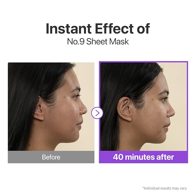 numbuzin No.9+ NAD+ BIO Lifting Full Face Mask, Peptide & Collagen Two-Piece Firming Mask for a Smooth, Defined-Looking Skin Finish, 4 Sheets + Lifting Band