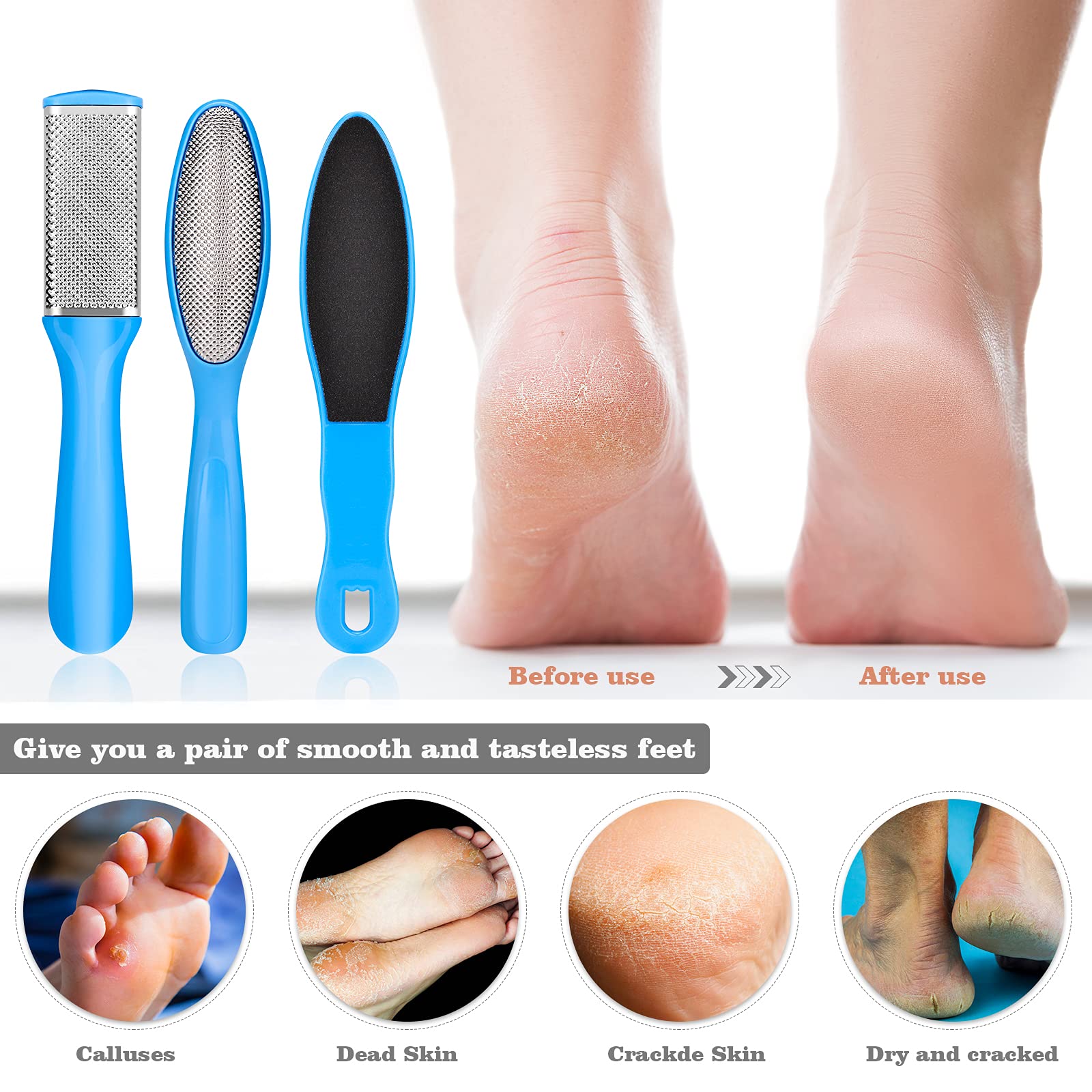 Pedicure Kits - Callus Remover for Feet, 23 in 1 Professional Manicure Set Pedicure Tools Stainless Steel Foot Care, Foot File Foot Rasp Dead Skin for Women Men Home Foot Spa Kit, Blue23