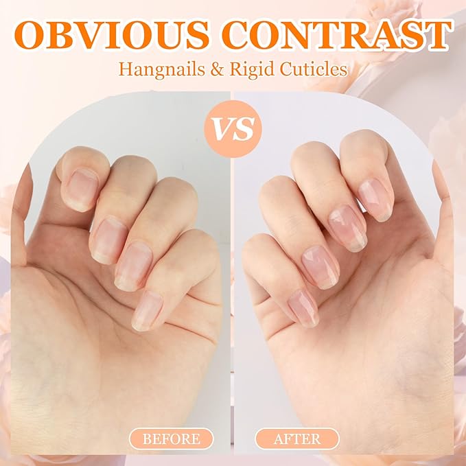 Meschett Cuticle Oil Pens with Nail File for Nail Care, 4PCS Nail Oil Pens with Natural Ingredients, Moisturizing Cuticle Oil for Fingernails and Toenails (Mix Flavors)