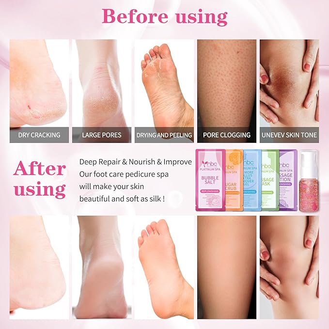 nbc BeautiLab Pedicure Foot Soak Set - Upgraded 6 in 1 Foot Spa, Foot Bath Spa, Pedicure Kit, Foot Soak for Tired & Dry Cracked Feet, Athletes Feet, Bad Odor, Softens Calluses (Rose)